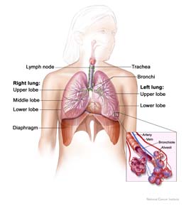 texas mesothelioma lawyer